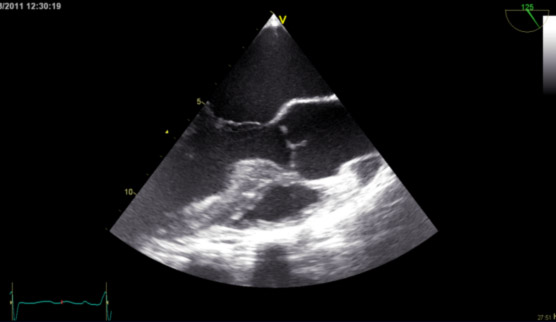 toe_ultrasound